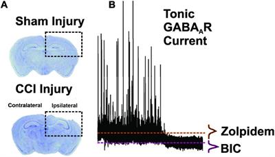 Zolpidem Profoundly Augments Spared Tonic GABAAR Signaling in Dentate Granule Cells Ipsilateral to Controlled Cortical Impact Brain Injury in Mice